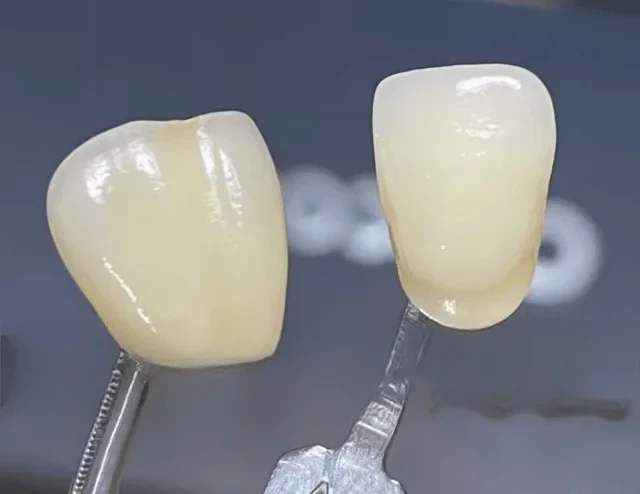 تأثير أفران تلبيد الأسنان على جودة الاستعادة والمتانة