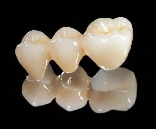 Sintered porcelain teeth