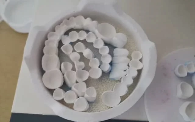 أسنان البورسلين غير الملبدة