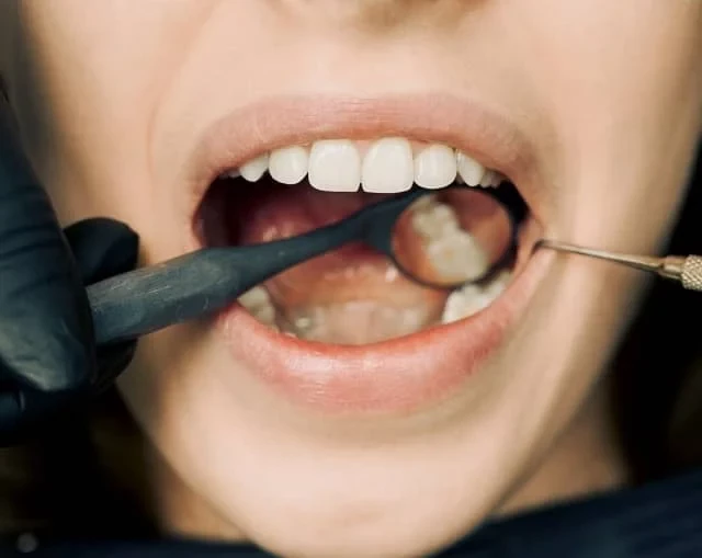 치과용 세라믹 전기로의 과학