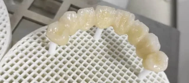Dientes de porcelana sinterizados en un horno de sinterización dental
