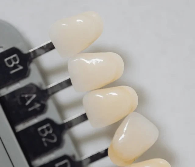 Dientes de porcelana sinterizada