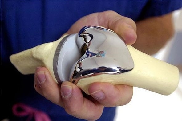 Medical Implants