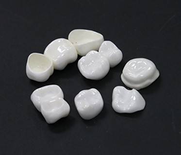 Impianti dentali
