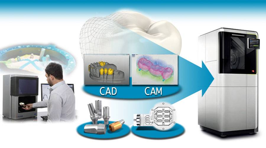 CAD/CAM 그라인딩 기술