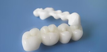 氧化锆陶瓷在牙科修复中的应用研究