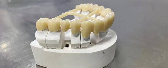 Protesi a microonde in zirconia