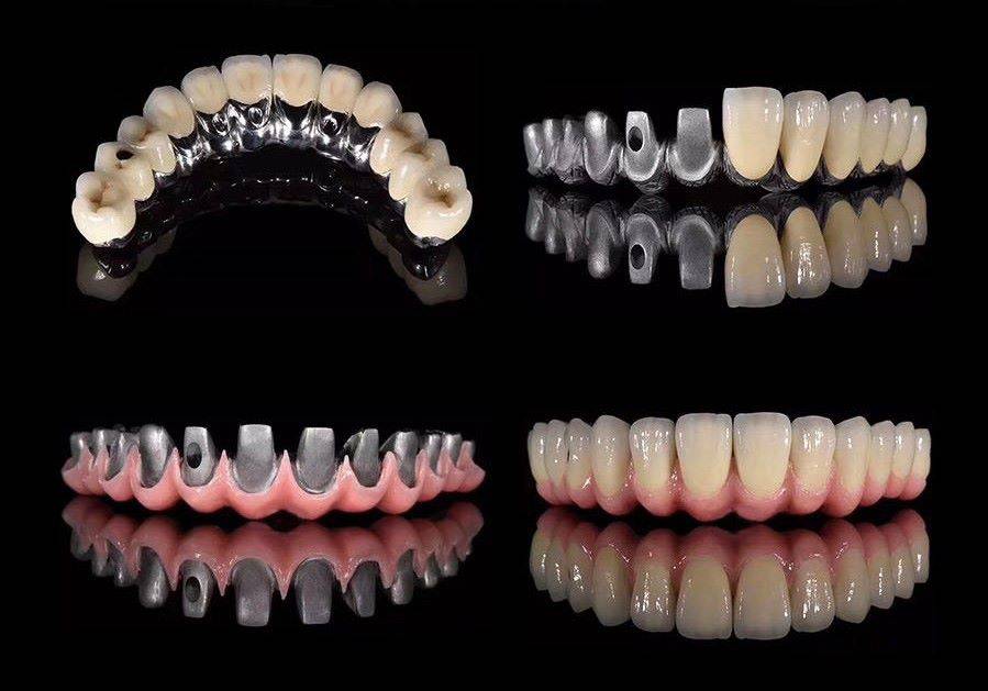 Protesi a microonde in zirconia