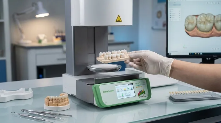 Quais são as vantagens das coroas de porcelana? Obtenha um sorriso natural e bonito com restauração durável