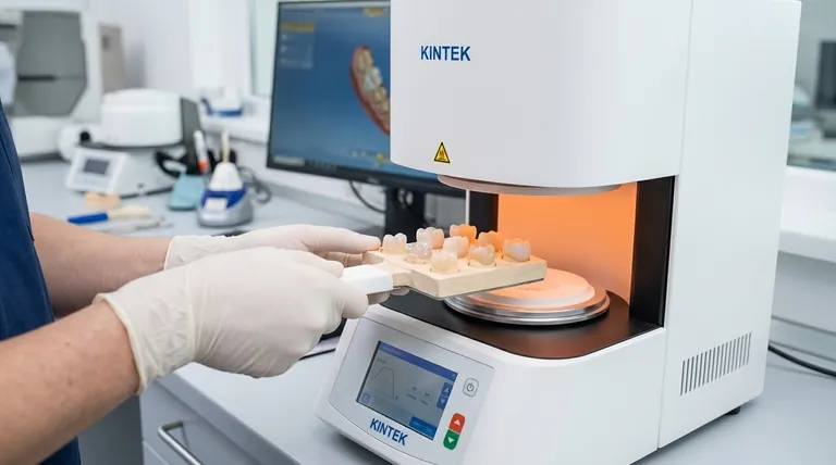 ما هو العيب الرئيسي لترميمات السيراميك بالكامل في الجزء الخلفي من الفم؟ التغلب على خطر الكسر للحصول على نتائج طويلة الأمد