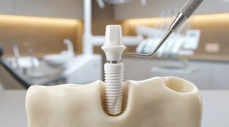 세라믹 임플란트는 얼마나 튼튼한가요? 금속 없는 미소를 위한 지르코니아의 힘을 알아보세요